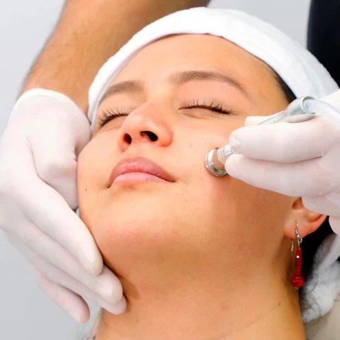 Limpieza facial profunda